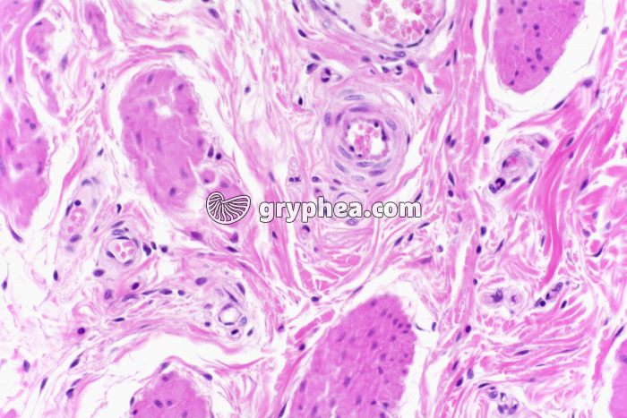 Capillaire sanguins et capillaire lymphatique CT x100 - gryphea.org